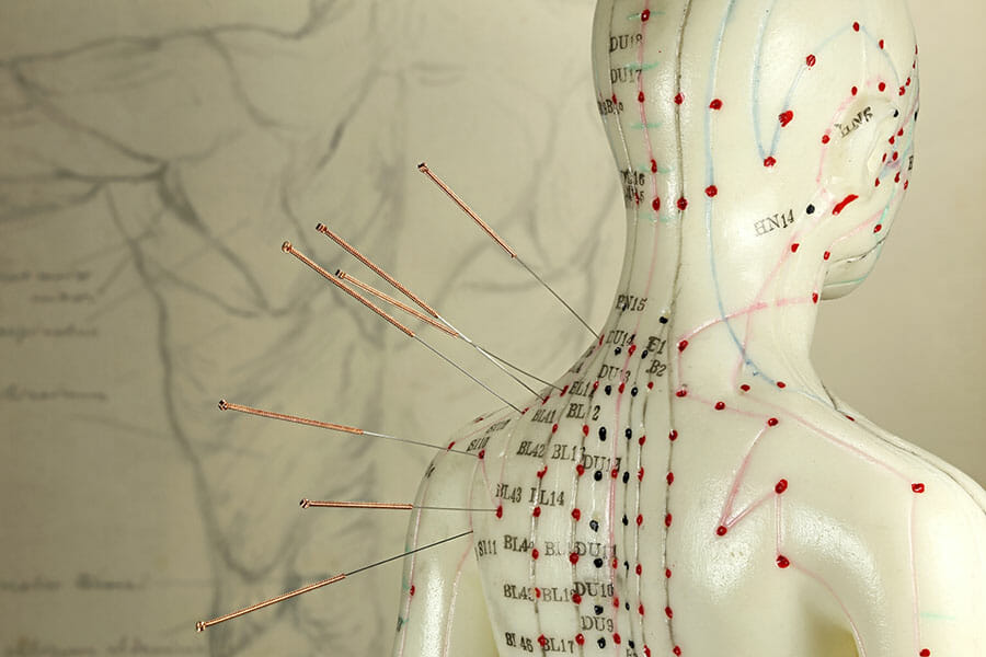 Acupuncture points from our oakville acupuncturist