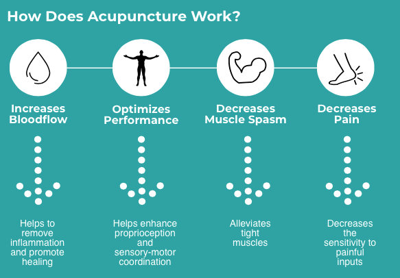 Acupuncture infographic oakville how our acupuncturist makes it work