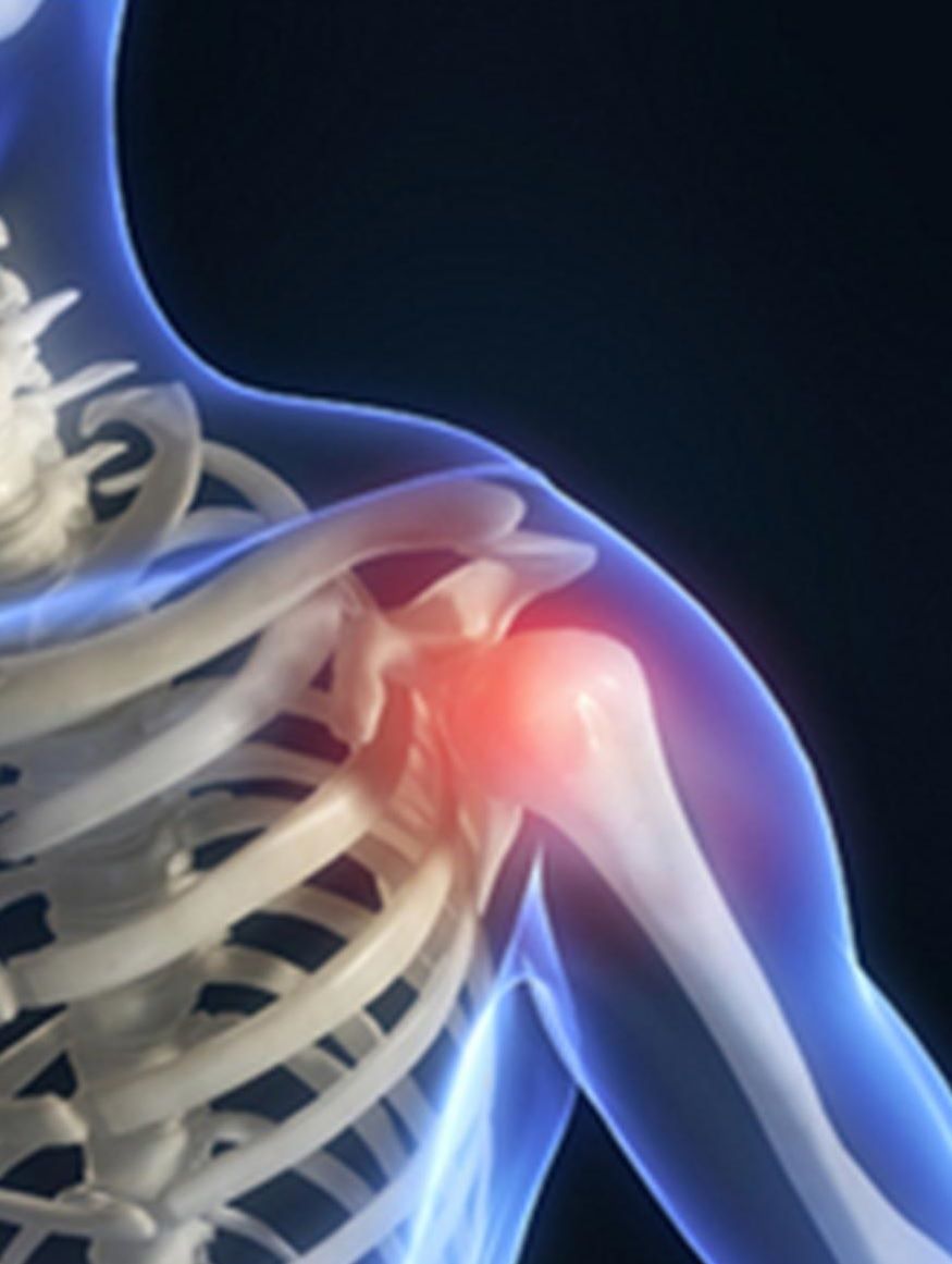 physiotherapy oakville shoulder treatment